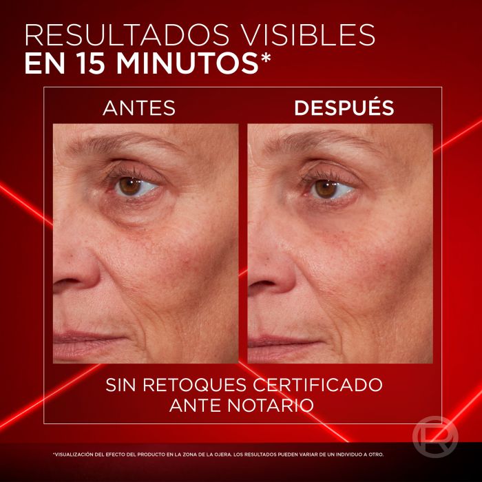 Revitalift Laser Corrector de Papos Instantâneo