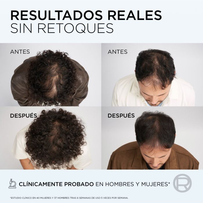 Elvive Growth Booster Sérum Antiqueda