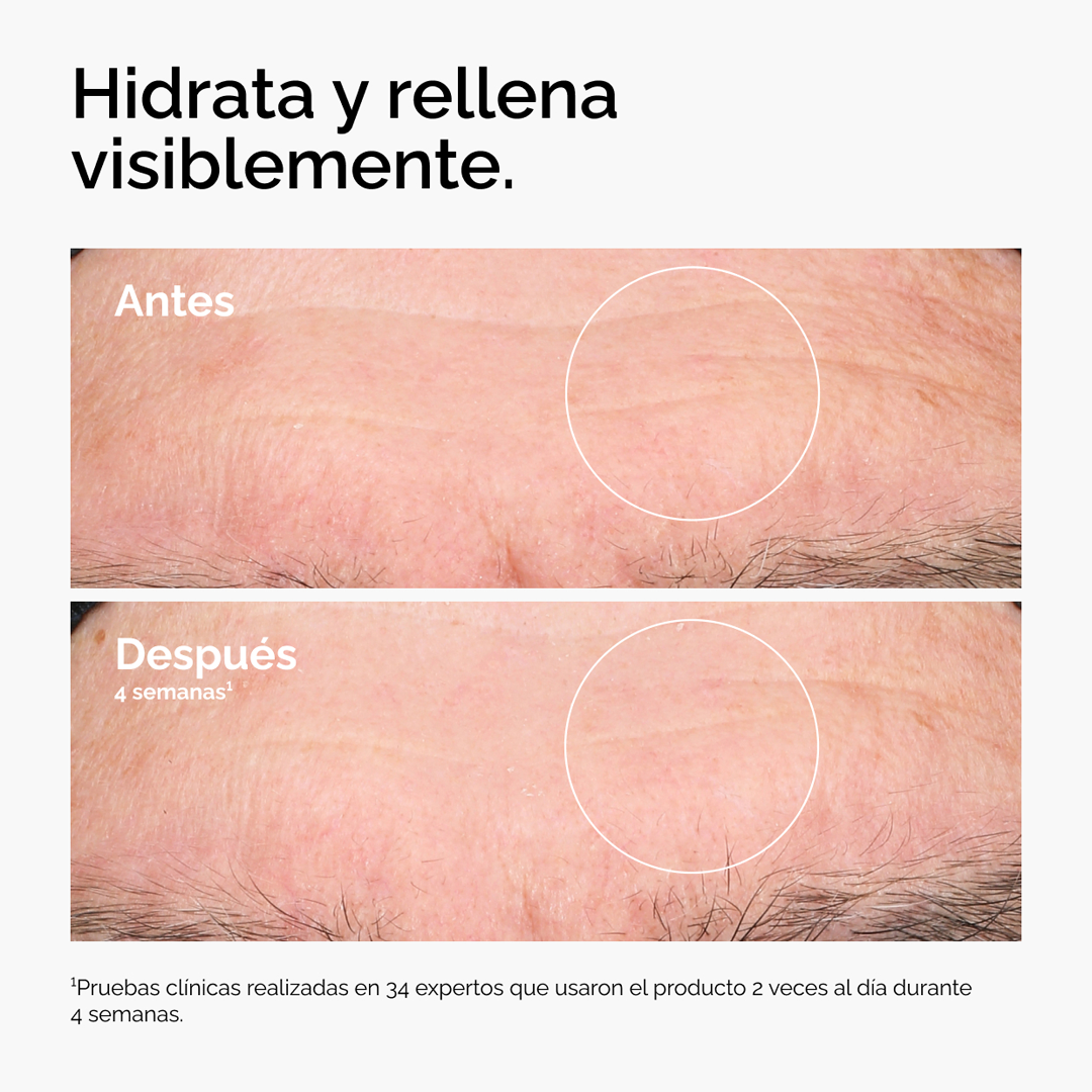 Ácido Hialurónico 2% + B5